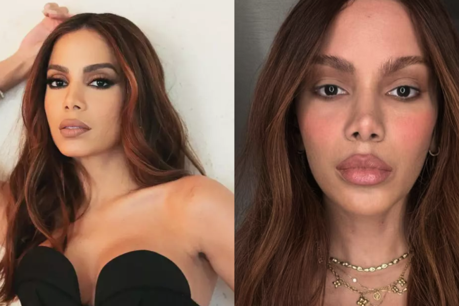 Anitta se pronuncia sobre plásticas no rosto e disse que Anitta se pronuncia sobre plásticas no rosto e disse que